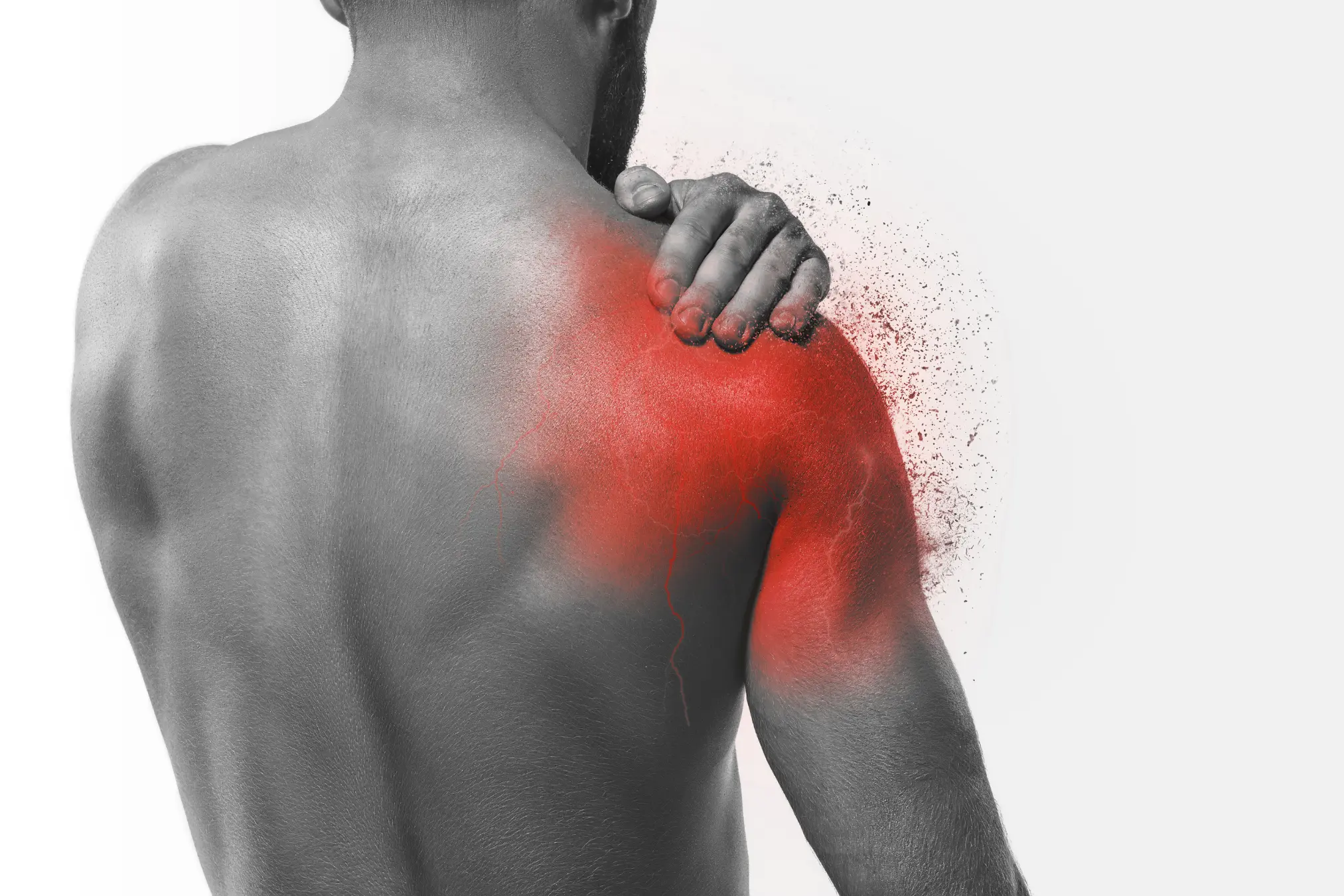 Frozen Shoulder diagram